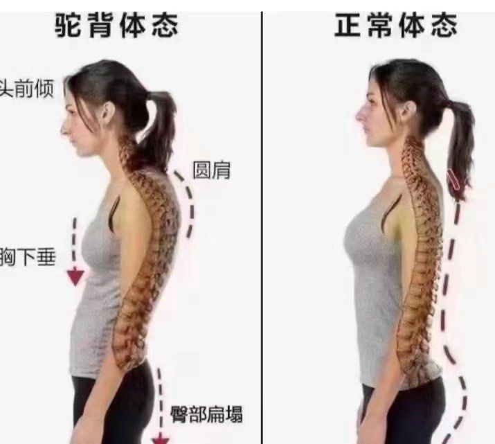体态可以矫正吗(图1)