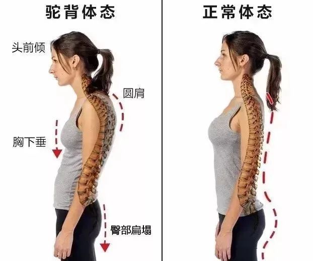 体态能矫正吗(图1)